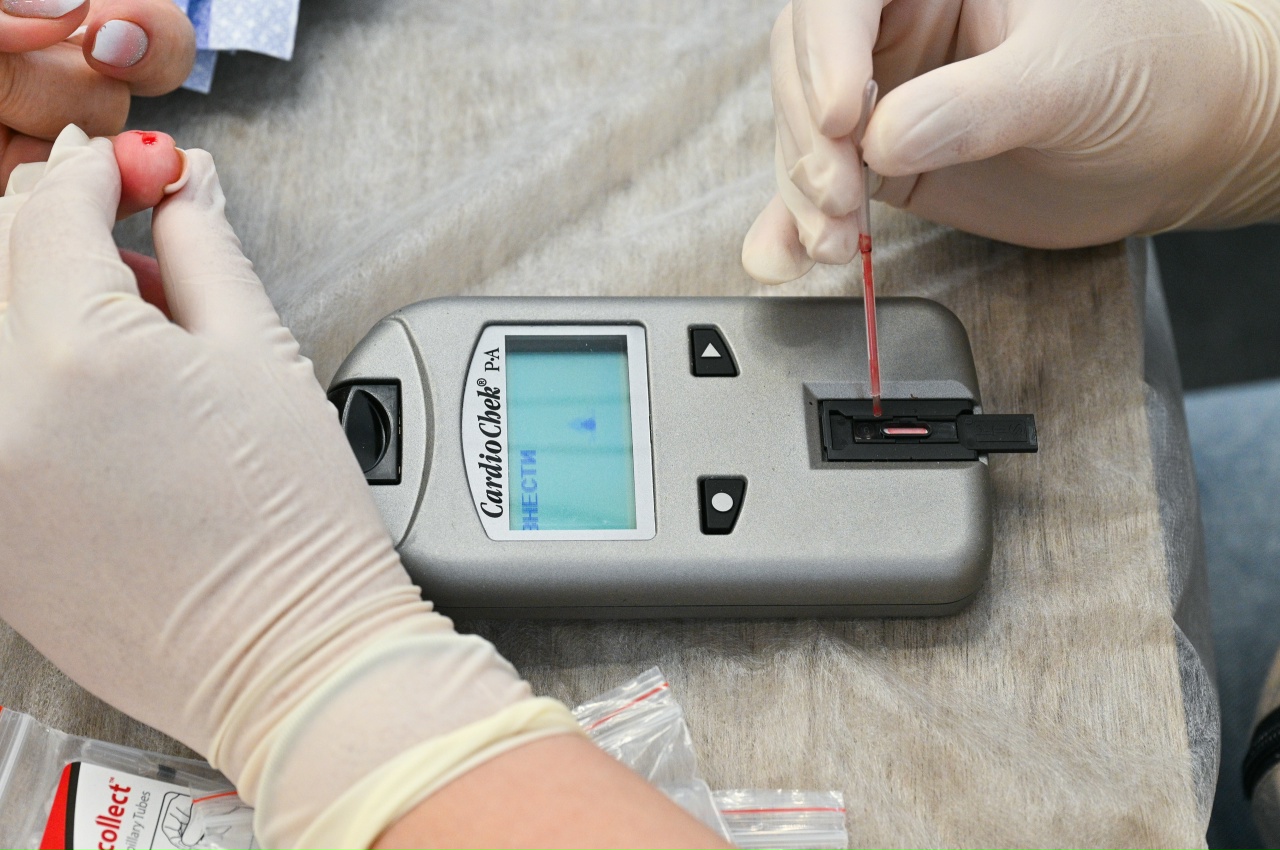 Саратовцы смогут проверить уровень «плохого» холестерина в торговом центре