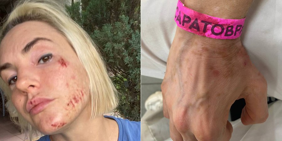 Толпа напала на семейную пару в загородном клубе «Роджер» под Саратовом, начинается суд